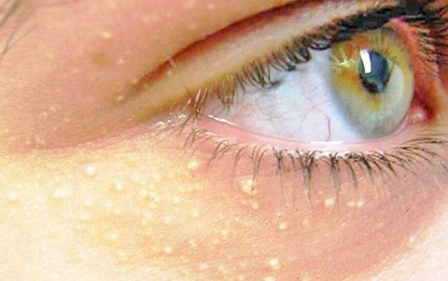 Pikat E Bardhaokkk 1140x570215483000217139787