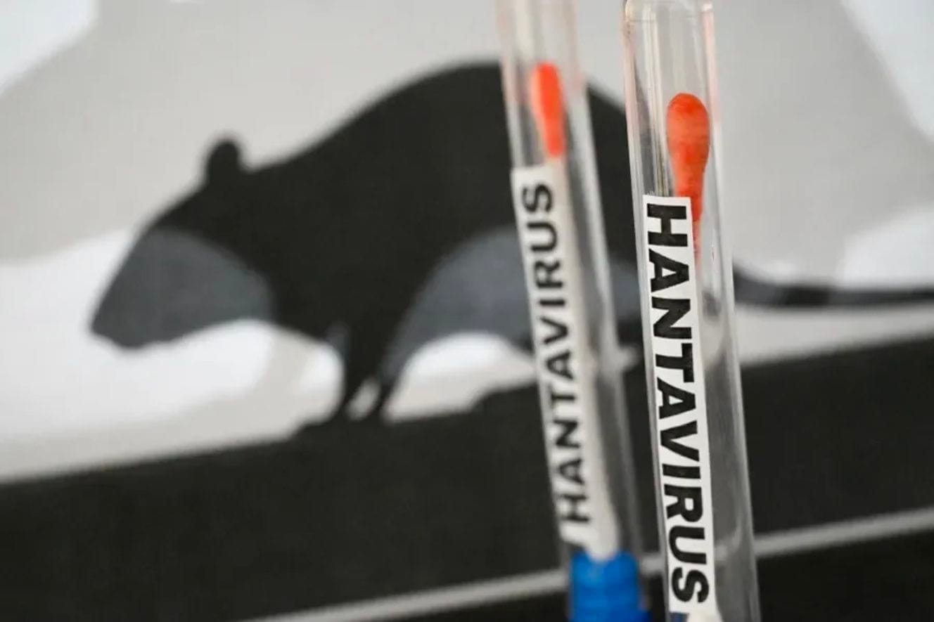 Alarm për hantavirusin: OBSH konfirmon rastin e 12-të, monitorohen qindra persona në 30 vende